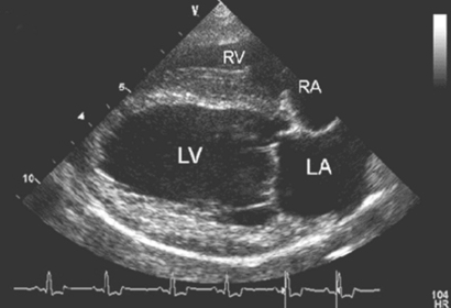 Canine Cardiovascular Graphic