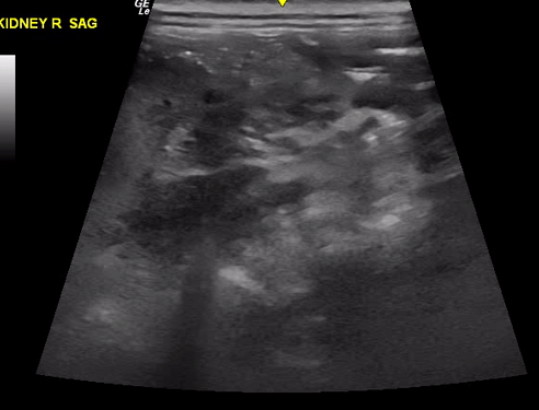 ultrasound gif